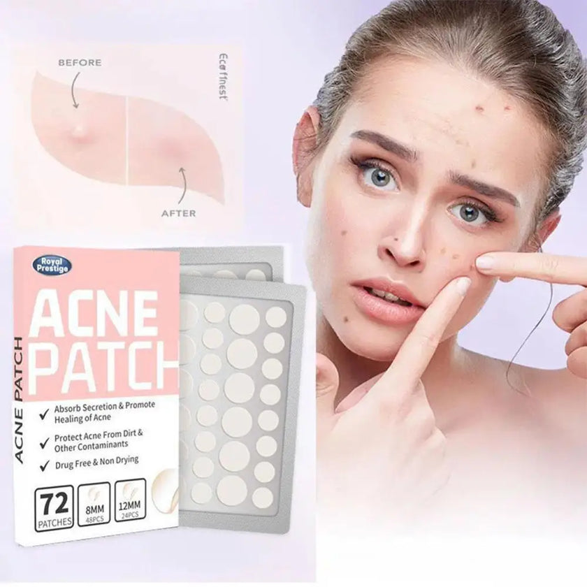 ClearSkin Hydrocolloid Acne Patches – Invisible & Healing